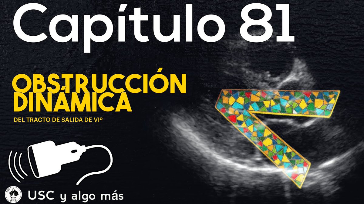 Nuevo video: Obstrucción dinámica del TSVI. Aprende a diagnosticarla y tratarla con ultrasonido clínico. ¡Mira ahora! 

youtu.be/oGAoqDz3AWE