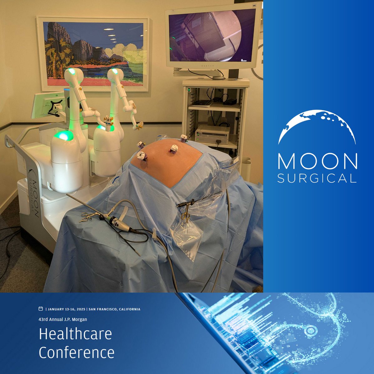 MoonSurgical (@moonsurg) on Twitter photo ๐ Moon Surgical is back at the 43rd Annual J.P. Morgan Healthcare Conference in San Francisco, California.
๐ค We are ready and excited to showcase the latest capabilities of the Maestro digital surgical assistant. Our schedule for the next few days is stacked, demonstrating the ๐ Moon Surgical is back at the 43rd Annual J.P. Morgan Healthcare Conference in San Francisco, California.
๐ค We are ready and excited to showcase the latest capabilities of the Maestro digital surgical assistant. Our schedule for the next few days is stacked, demonstrating the