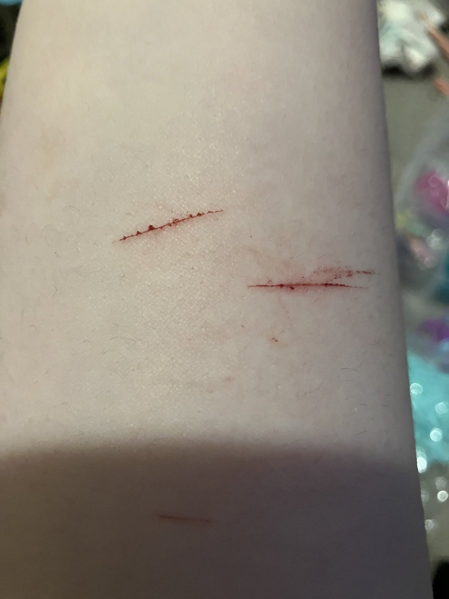 ObsessiveFr3ak's tweet photo. Relapse https://t.co/ZRXgtXcup8