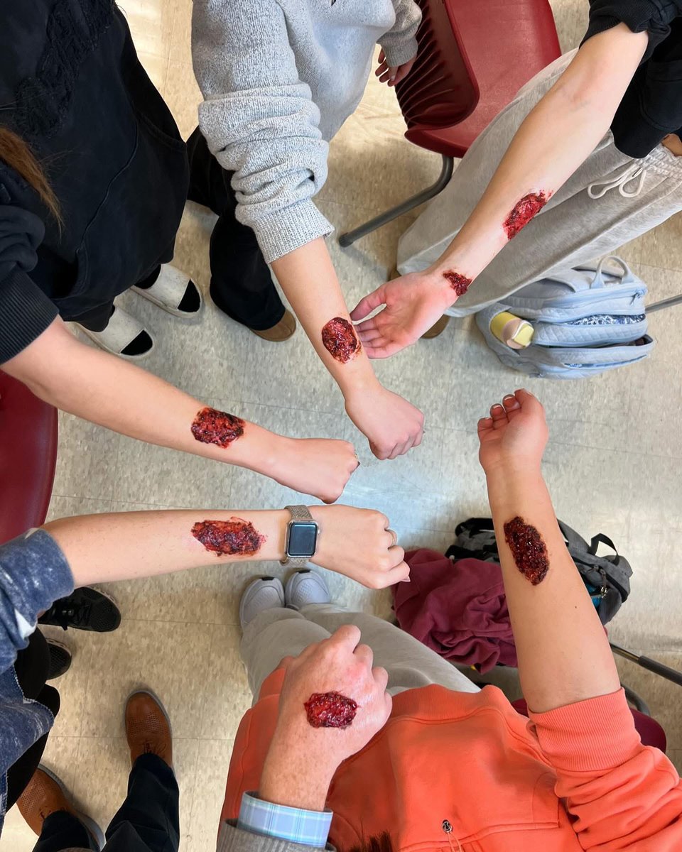 bcooper71's tweet image. I’m constantly in awe of the amazing things our teachers let our students do each day. 

Today, I was a laceration victim in our medical academy.