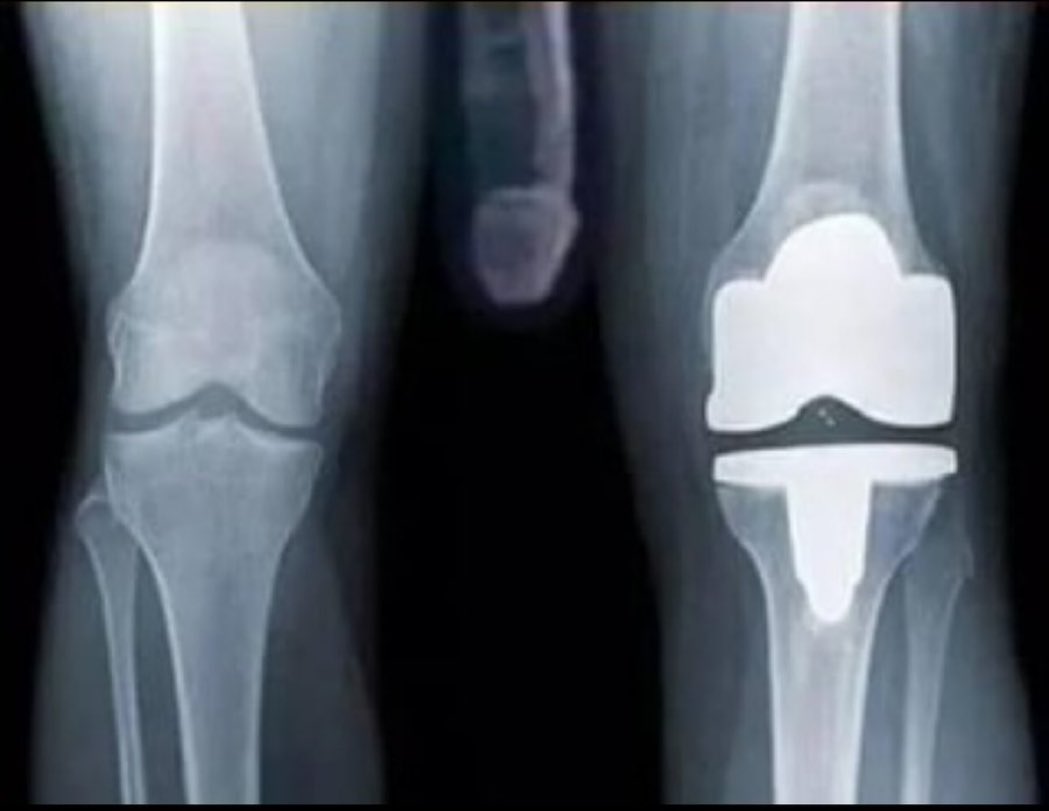 richwasted's tweet photo. I just dislocated my knee please pray for me guys 🙏 https://t.co/OX6JAuMJ5c
