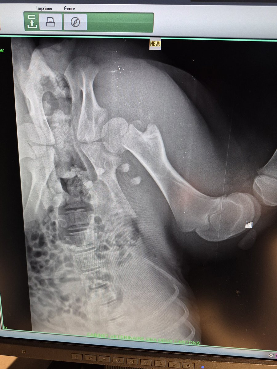 Rien de grave après vérification. Vêlage difficile pour une petite cularde coincée au bassin. J'avais peur de l'avoir dérotulée mais c'est juste les ligaments. On va lui faire une attelle avec une chambre à air. Pas facile la campagne de vêlage cette année...