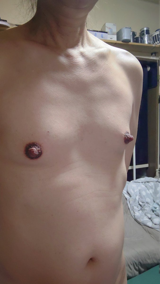 小さくなった😓