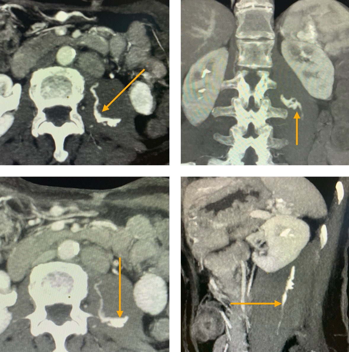 Karan Anandpara tweet media