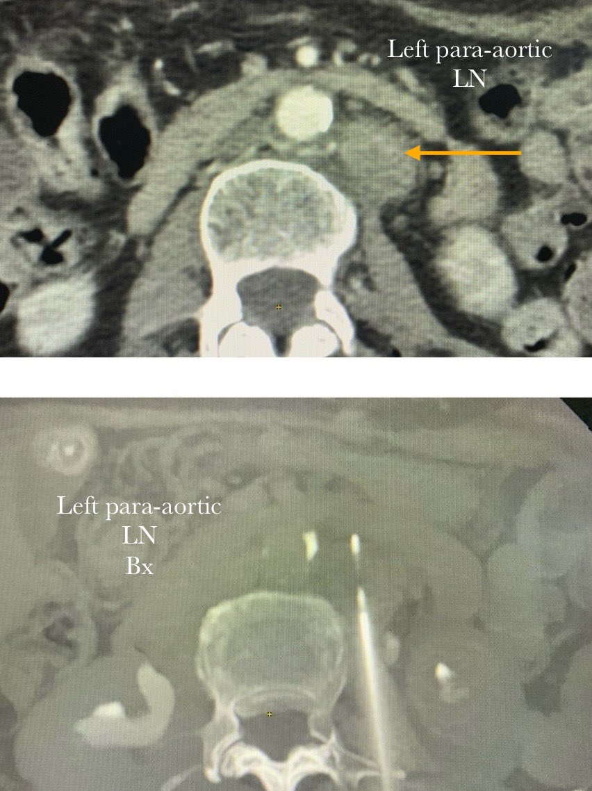 Karan Anandpara tweet media
