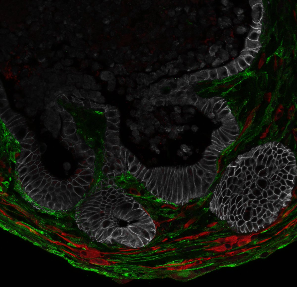 First Preprint from BD lab! 🚀
I’m beyond excited to share our ENS-Rich Assembloids (ERAs) - a breakthrough tool for studying the Enteric Nervous System (ENS)! 🔬🧫 <a href="/ilkesarii/">İlke Sarı</a> @nurik__satlykov <a href="/TomasValenta13/">TomasValenta</a> @belizuzun 
Check it out 👉biorxiv.org/cgi/content/sh…