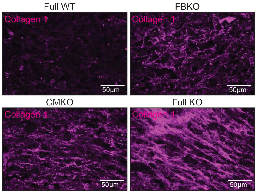 Journal of Clinical Investigation (@jclinicalinvest) on Twitter photo BAG3 mutations cause dilated cardiomyopathy but most research has focused on its function in heart muscle cells rather than other cardiac cell types
<a href="/BryanZWang/">Bryan Wang</a> <a href="/MaggieMorsink/">Margaretha Morsink</a> <a href="/GVNlab/">Gordana Vunjak-Novakovic</a> & team used engineered heart tissue to reveal role of BAG3 in cardiac fibroblasts in fibrosis: BAG3 mutations cause dilated cardiomyopathy but most research has focused on its function in heart muscle cells rather than other cardiac cell types
<a href="/BryanZWang/">Bryan Wang</a> <a href="/MaggieMorsink/">Margaretha Morsink</a> <a href="/GVNlab/">Gordana Vunjak-Novakovic</a> & team used engineered heart tissue to reveal role of BAG3 in cardiac fibroblasts in fibrosis:
