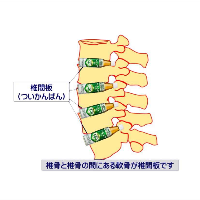 Alice_anmitsu's tweet photo. 椎間板ヘルシア https://t.co/kot5dJKS1r