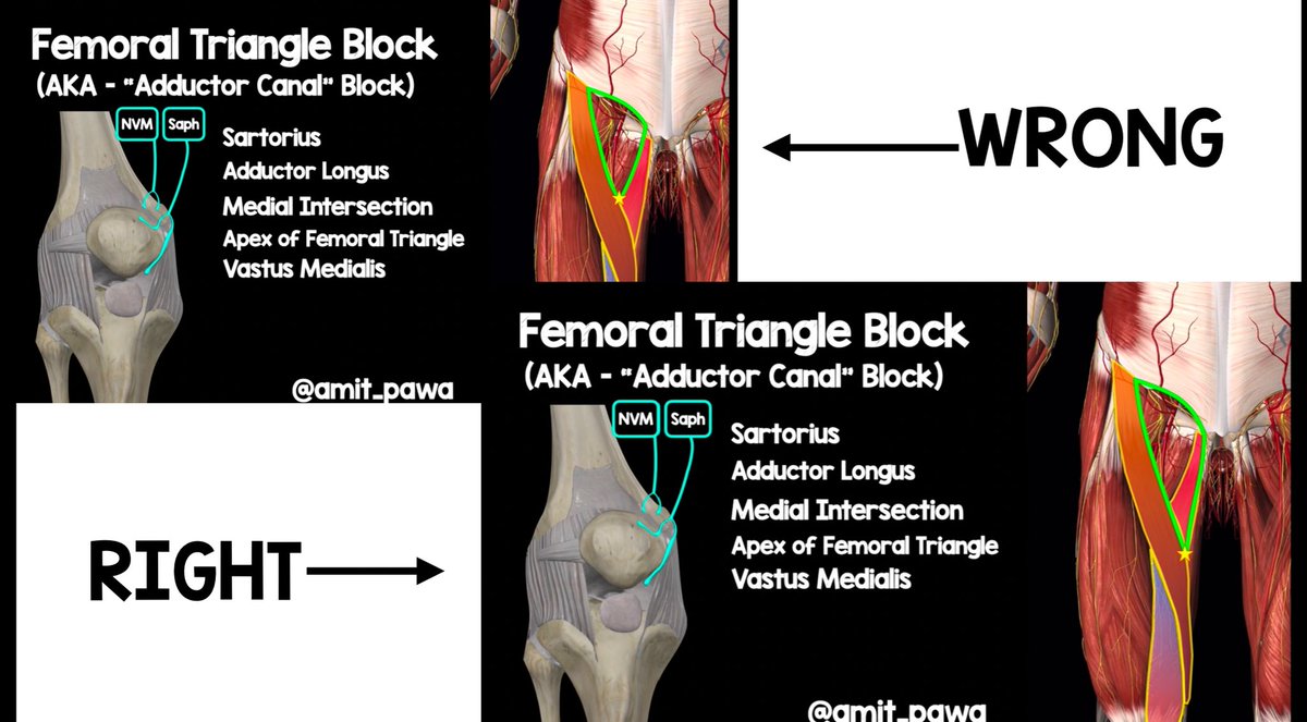 Dr Amit Pawa💉🎙️ tweet media