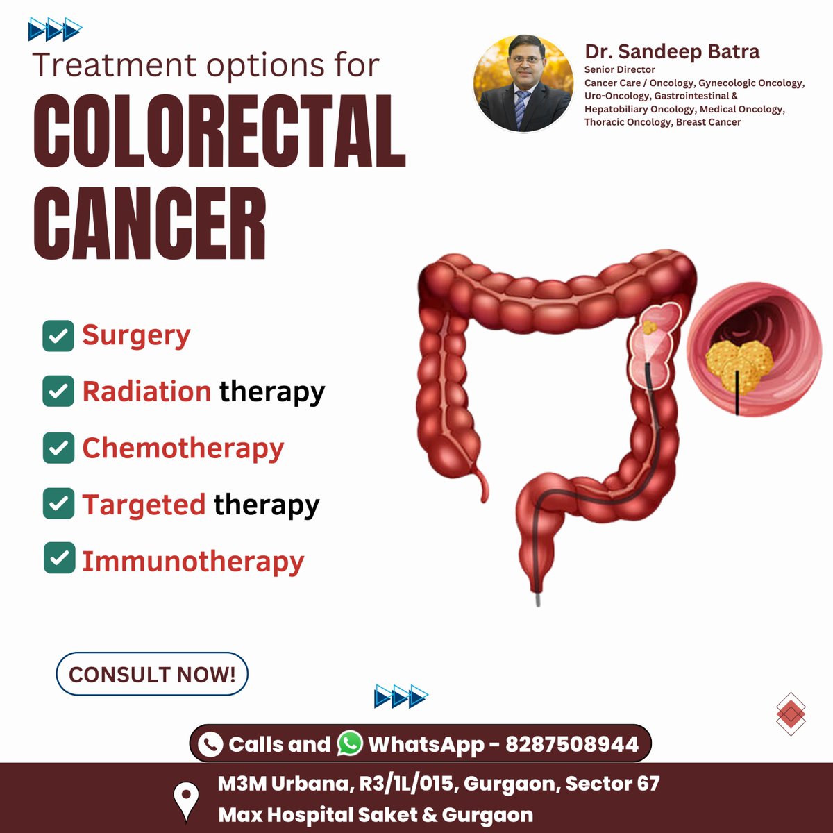 Treatment options for COLORECTAL CANCER
Surgery
Radiation therapy
Chemotherapy
Targeted therapy
Immunotherapy

👨‍⚕️Dr. Sandeep Batra
Consultant:- Cancer Expert
Contact us at 📲8287508944
Visit us 📍M3M Urbana, R3/1L/015, Gurgaon, Sector 67 Max Hospital Saket &amp; Gurgaon