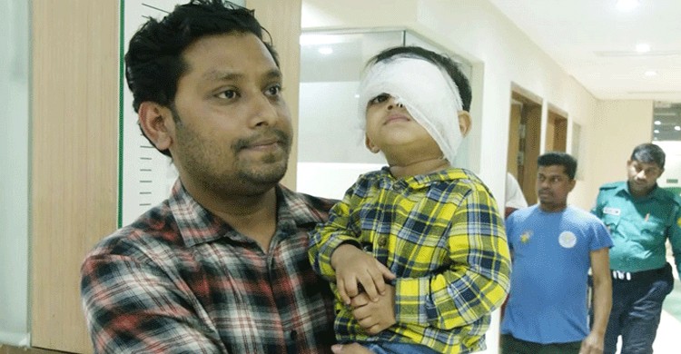 বাম চোখে সমস্যা, শিশুর ডান চোখ অপারেশন করলেন চিকিৎসক