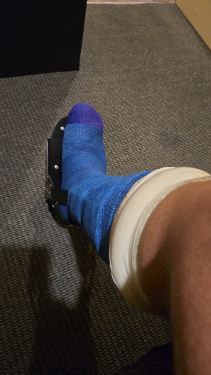 casperscoffee's tweet photo. Throught I would give a quick update with regards to being closed for some time, unfortunately when you have toes removed it can take sometime to heal and being in a cast makes stairs a health and safety issue 🤣 once I get the all clear we will be back open. - Thomas https://t.co/ELiesIv6kv