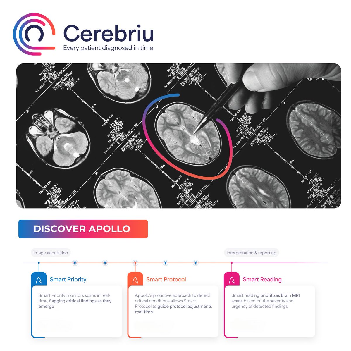 ISMRMbenelux's tweet image. 📣For the first time CEREBRIU will be joining us at the ISMRM Benelux 2025 Annual Meeting. Don’t miss the chance to connect with their team to learn more about their flagship solution!