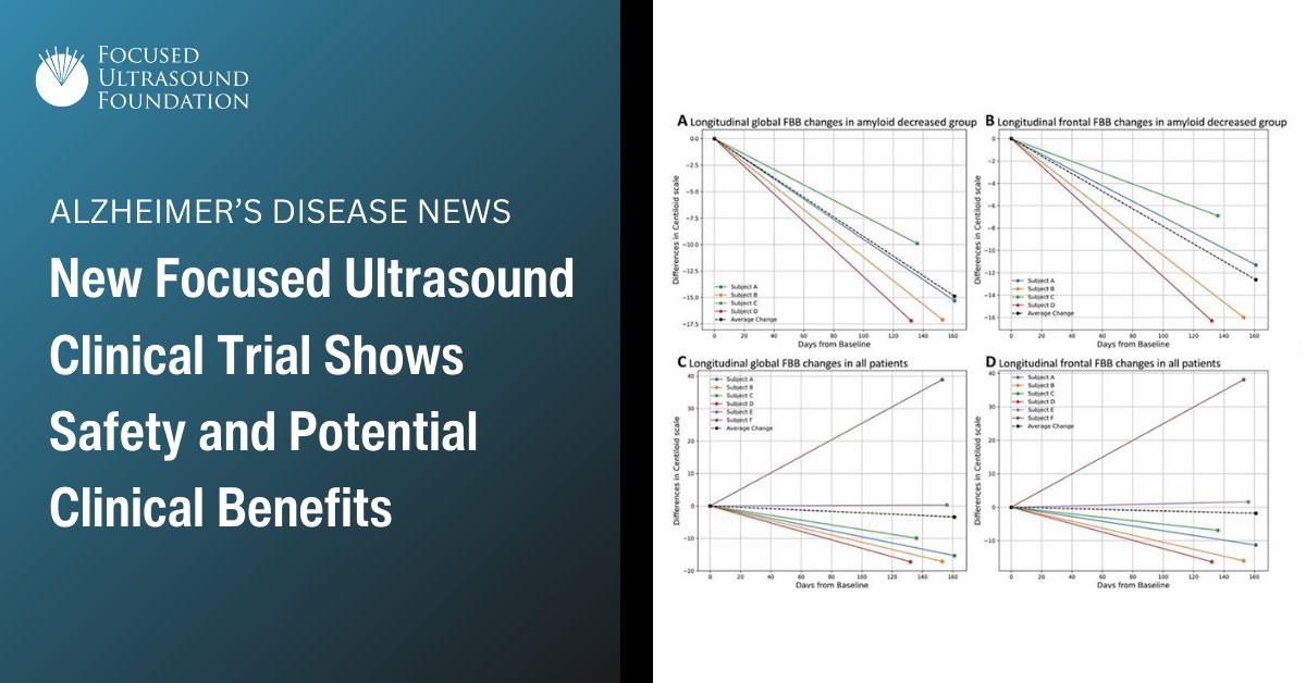 Focused Ultrasound for Alzheimer’s Disease: Results from a clinical trial using focused ultrasound to treat Alzheimer’s disease have now been published in <a href="/TheJNS/">Journal of Neurosurgery</a>. The study, led by Jin Woo Chang, MD, PhD, in Seoul, Korea, found that opening the blood-brain barrier with focused