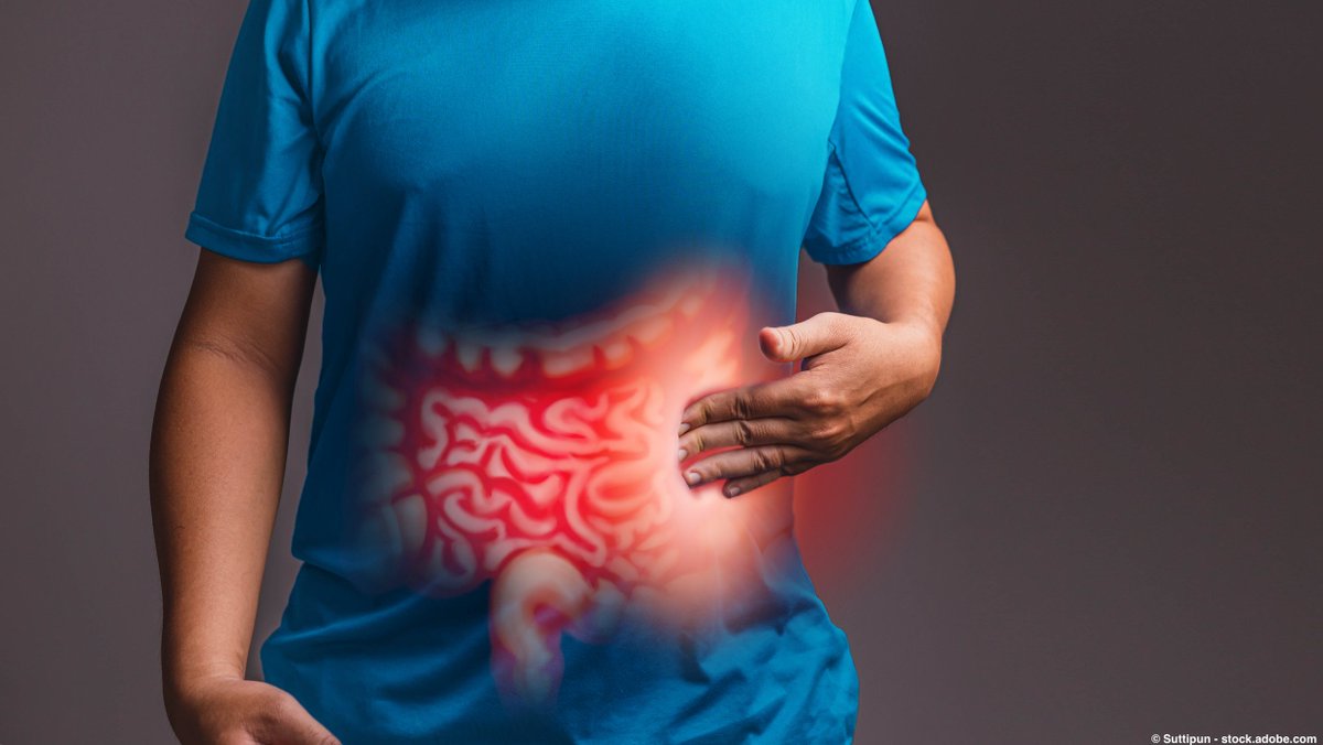 OncLive's tweet image. The Claudin18.2–directed autologous CAR T-cell therapy satri-cel led to a statistically significant improvement in PFS vs physician’s choice of therapy in patients with CLDN18.2-positive advanced gastric/GEJ cancer.
#stcsm #Oncology #MedTwitter
onclive.com/view/satri-cel…