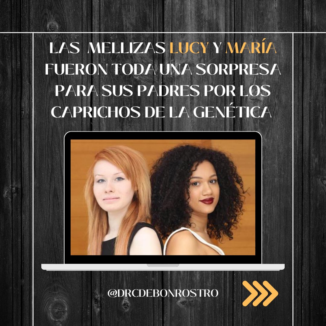 ⚠️ Las mellizas Lucy y María fueron toda una sorpresa para sus padres por los caprichos de la genética 👶🏾👶🏼

Y tú, ¿conocías este curioso caso? 🤓

#genética #gemelos #diversidadhumana #ciencia #reproducciónhumana