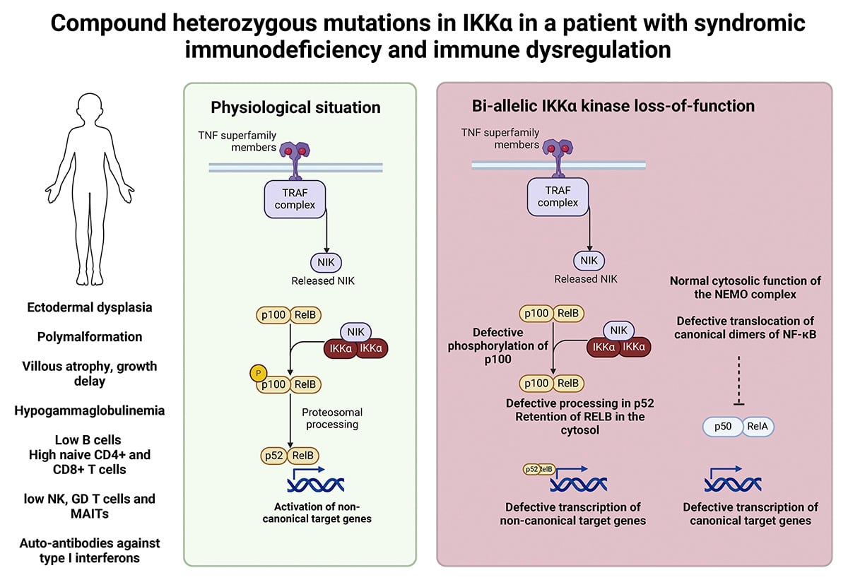 Journal of Experimental Medicine (@jexpmed) on Twitter photo .<a href="/PixelleQR/">Quentin Riller</a>, Rieux-Laucat et al <a href="/InstitutImagine/">Institut Imagine</a> show that IKKα kinase deficiency causes syndromic #immunodeficiency & immune dysregulation as a consequence of a major defect in the non-canonical NF-κB pathway and a partial defect in the canonical pathway hubs.la/Q032HC0Z0 .<a href="/PixelleQR/">Quentin Riller</a>, Rieux-Laucat et al <a href="/InstitutImagine/">Institut Imagine</a> show that IKKα kinase deficiency causes syndromic #immunodeficiency & immune dysregulation as a consequence of a major defect in the non-canonical NF-κB pathway and a partial defect in the canonical pathway hubs.la/Q032HC0Z0