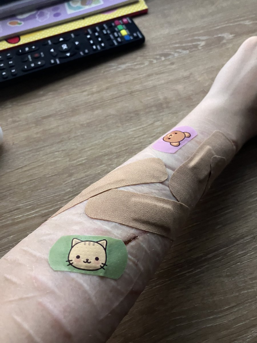 kiridekulvr's tweet photo. is it really self harm if it includes cute bandaids.. https://t.co/HvWIA5cASe