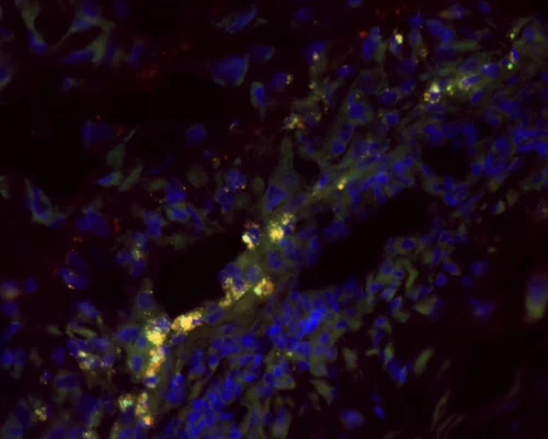 Yellow coloring in this microscope image is the mark of successful delivery of gene therapy via nanoparticles into placental cells from monkeys (each marked by blue-colored nuclei) and expression of a gene expected to boost the fetus-nourishing health of the placenta.