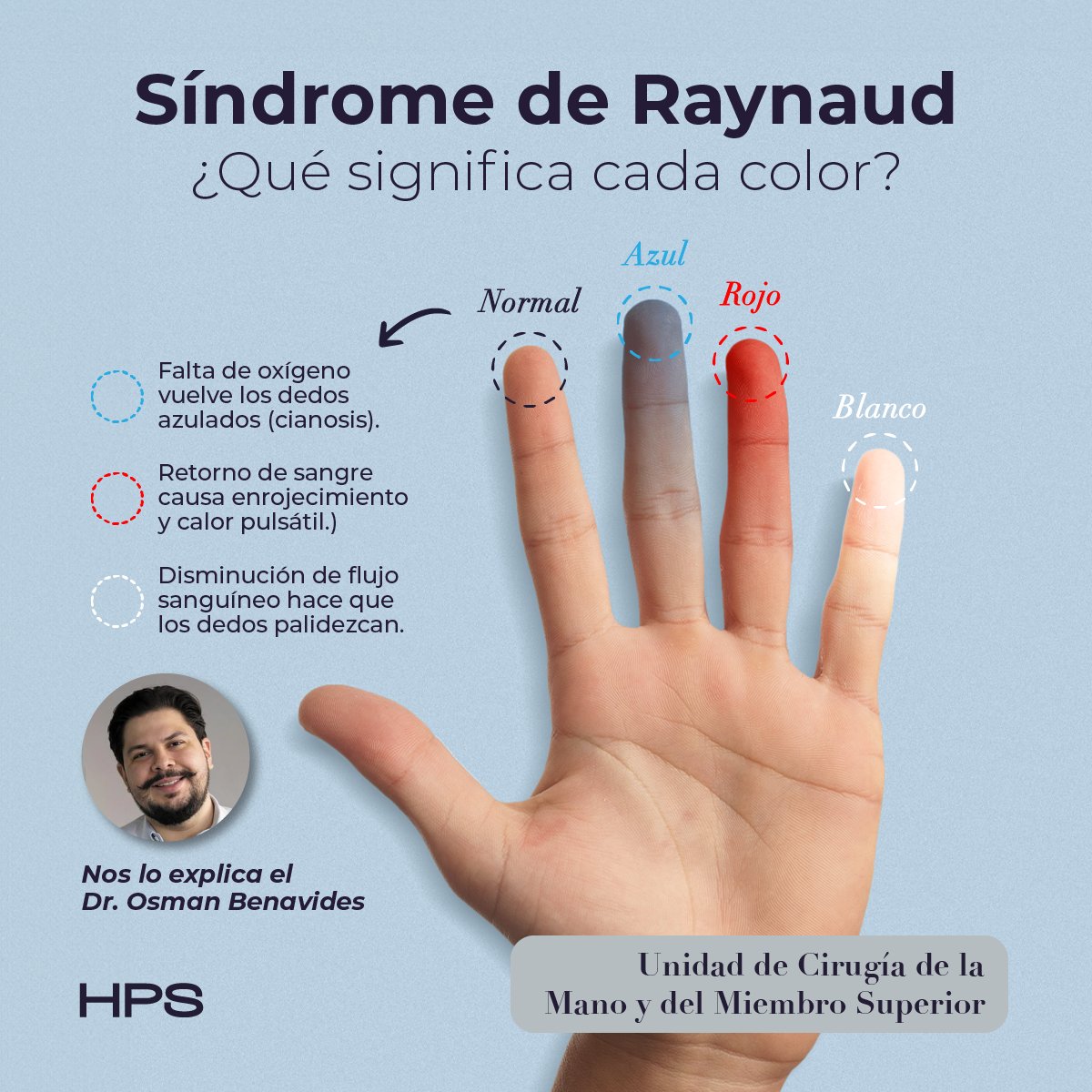 ¿Has notado que tus dedos se vuelven blancos, azules o rojos cuando hace frío o estás estresado? Esto podría ser el Síndrome de Raynaud.

¿Qué es?

Descúbrelo en nuestro Instagram y Facebook.