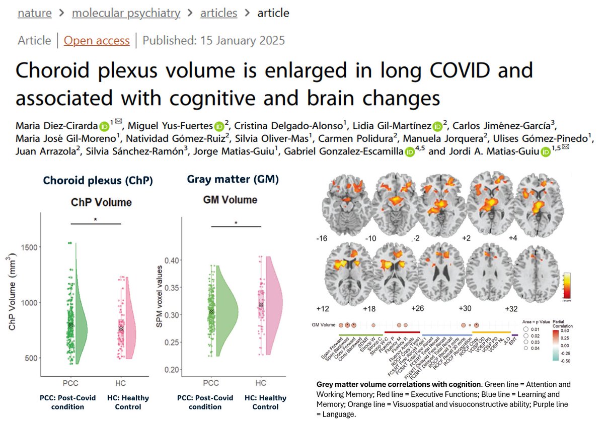 Wow, I was looking at the Choroid Plexus from #COVID last week for the first time and thinking, why is so large? 5 days later a study came out showing the same in 129 patients with #LongCovid. Also, Cognitive Dysfunction and Grey Matter Vol reduction (=neuron loss). #NeuroCovid