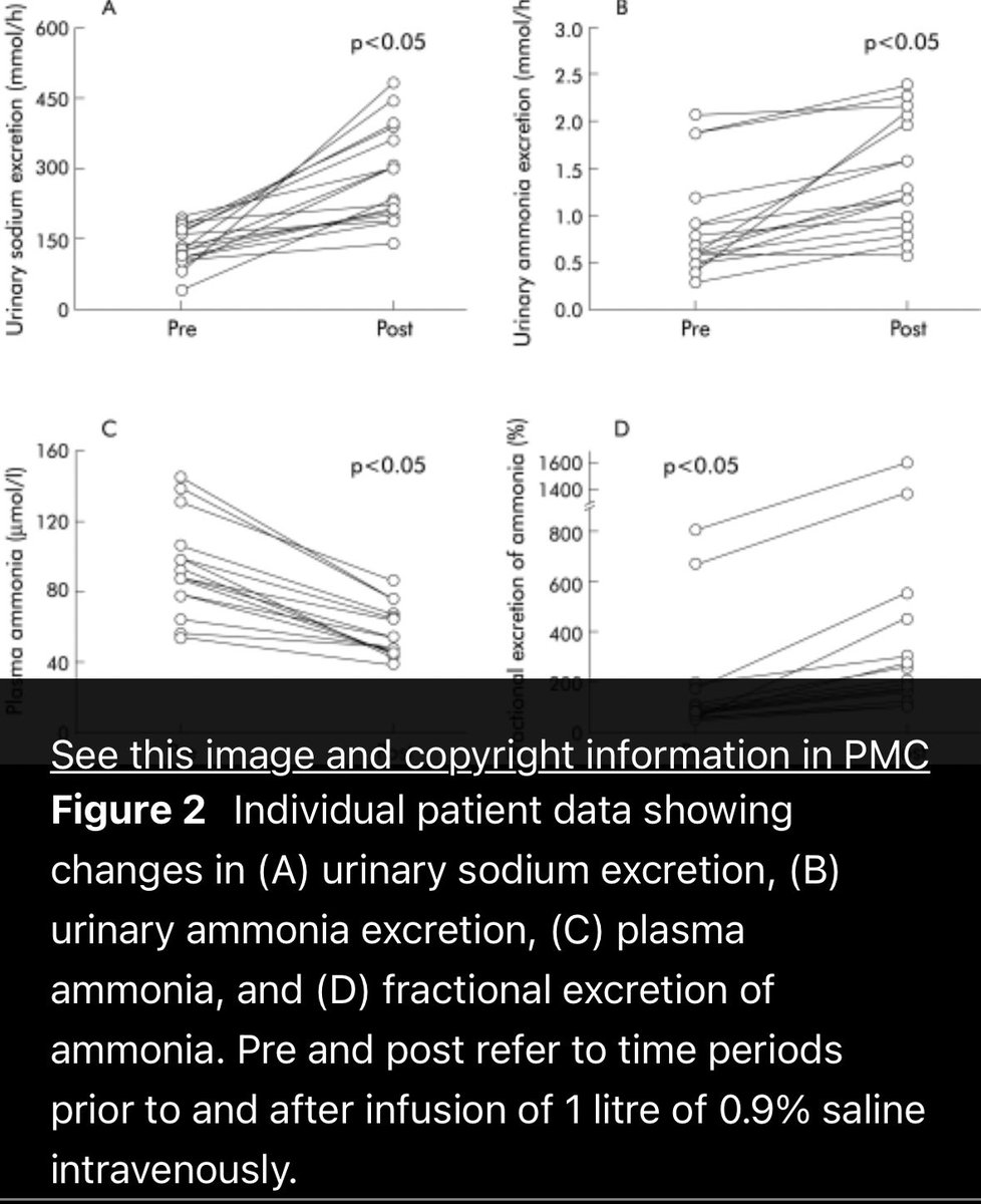 <a href="/RoyAHep/">Akash Roy</a> <a href="/PrajnaAnirvan/">Prajna Anirvan</a> <a href="/ebtapper/">Elliot Tapper</a> <a href="/JasmohanBajaj/">Jasmohan Bajaj</a> <a href="/AndrewMMoon/">Andrew Moon</a> <a href="/BloomPringle/">Patty Pringle Bloom, M.D.</a> <a href="/RajivJalan1/">Prof Rajiv Jalan</a> That’s a good Q!  Volume expansion alone is effective at lowering blood NH3 but LOLA in itself provides a substrate to facilitate hepatic glutamine production. That said, LOLA only works when patients have good renal function as the the glutamine is renally excreted.
