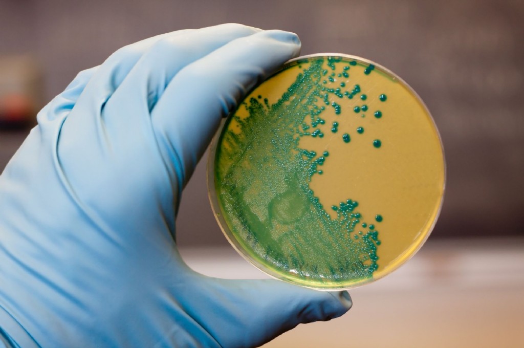 Patentan nuevo método para combatir la listeria en los alimentos

La investigación práctica del CSIC logra eliminar hasta el 99,99% de los patógenos de sus células en ensayos realizados

Noticia completa👇
qcom.es/csic/industria…