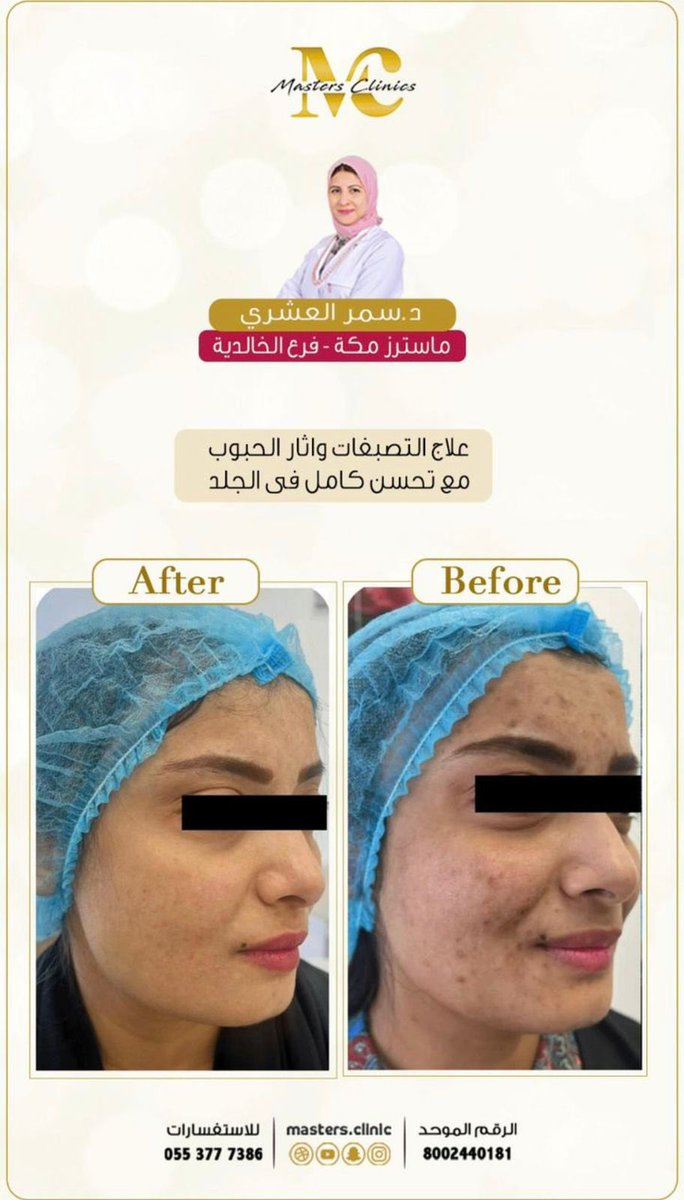 فريقنا الطبي في انتظار زيارتك للعناية بصحتك وجمالك في عيادات ماسترز ✨

د.سمر العشري
اخصائية الجلدية والليزر 

احجز الآن 
8002440181

📍فرع مكة الخالدية 

 g.co/kgs/bJPo8cV