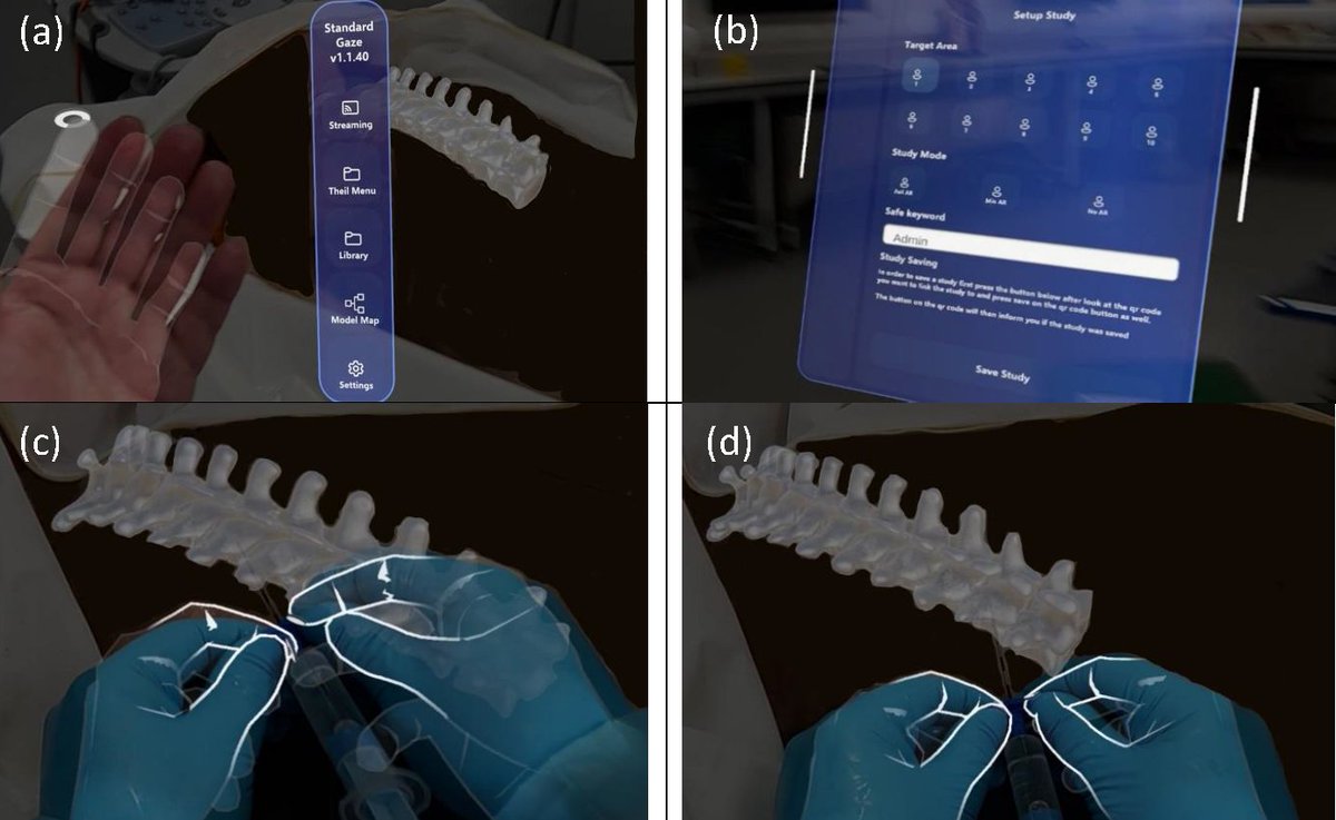 Professor Graeme McLeod (@gamcleod2) on Twitter photo Thankyou <a href="/Assoc_Anaes/">Association of Anaesthetists</a> First prize: Innovation award 2025 for: Hologram assisted thoracic epidural insertion using an augmented reality headset <a href="/ESRA_Society/">ESRA | European Society of Regional Anaesthesia</a> <a href="/RegionalAnaesUK/">RA-UK</a> <a href="/NIAAResearch/">NIAA Research</a> <a href="/OptomizeLtd/">Optomize</a> <a href="/xrealitylabs/">xrealitylabs</a> <a href="/DeblurLtd/">Deblur Ltd</a> Thankyou <a href="/Assoc_Anaes/">Association of Anaesthetists</a> First prize: Innovation award 2025 for: Hologram assisted thoracic epidural insertion using an augmented reality headset <a href="/ESRA_Society/">ESRA | European Society of Regional Anaesthesia</a> <a href="/RegionalAnaesUK/">RA-UK</a> <a href="/NIAAResearch/">NIAA Research</a> <a href="/OptomizeLtd/">Optomize</a> <a href="/xrealitylabs/">xrealitylabs</a> <a href="/DeblurLtd/">Deblur Ltd</a>