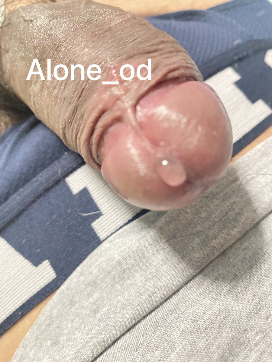 alone_od's tweet photo. สถานะการณ์ตอนนี้😁 https://t.co/Llur40JfpD