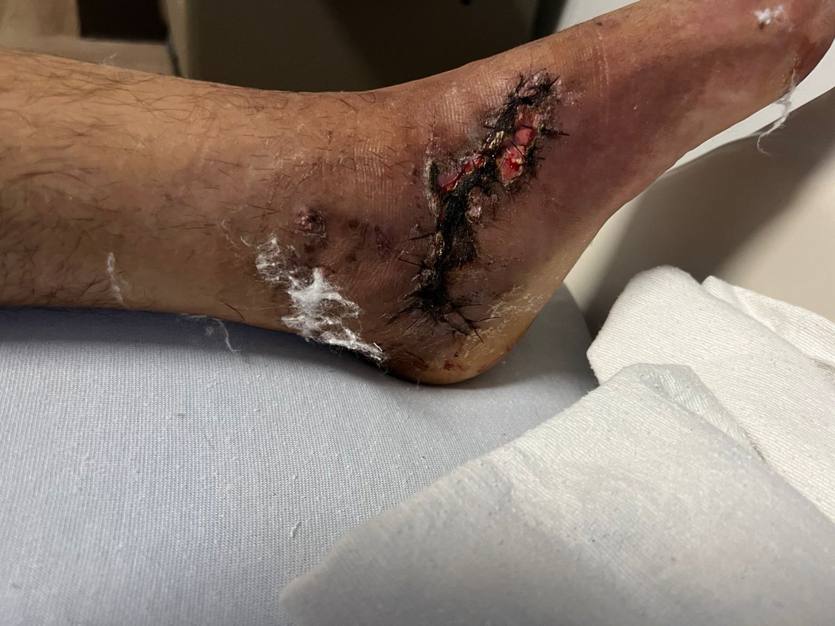 DTN-Pikoro tweet media