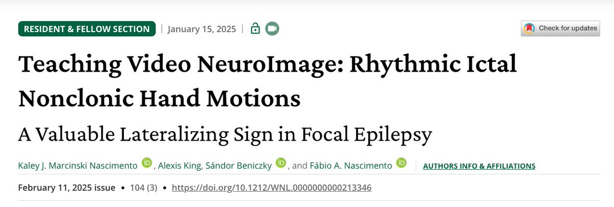 Fábio Nascimento (@fabnascimen) on Twitter photo #RINCH motions are usually contralateral to the EZ. It is key to differentiate #RINCH motions from gestural automatisms bc the latter are typically ipsilateral to the EZ when the contralateral extremity has dystonic posturing. <a href="/KNascimenski/">Kaley Marcinski Nascimento</a> <a href="/SBeniczky/">Sandor Beniczky</a>
pubmed.ncbi.nlm.nih.gov/39813631/ #RINCH motions are usually contralateral to the EZ. It is key to differentiate #RINCH motions from gestural automatisms bc the latter are typically ipsilateral to the EZ when the contralateral extremity has dystonic posturing. <a href="/KNascimenski/">Kaley Marcinski Nascimento</a> <a href="/SBeniczky/">Sandor Beniczky</a>
pubmed.ncbi.nlm.nih.gov/39813631/