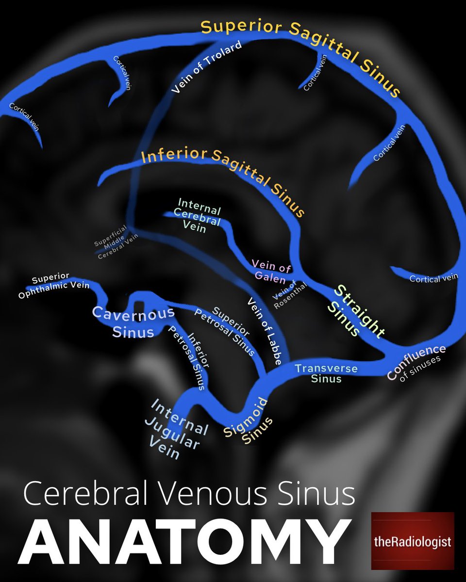 Cerebral venous sinus anatomy