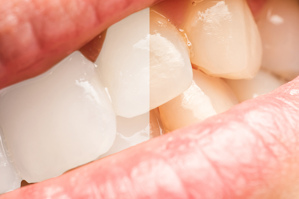 Oyster Point Dental (@OysterPtDental) / Posts / X