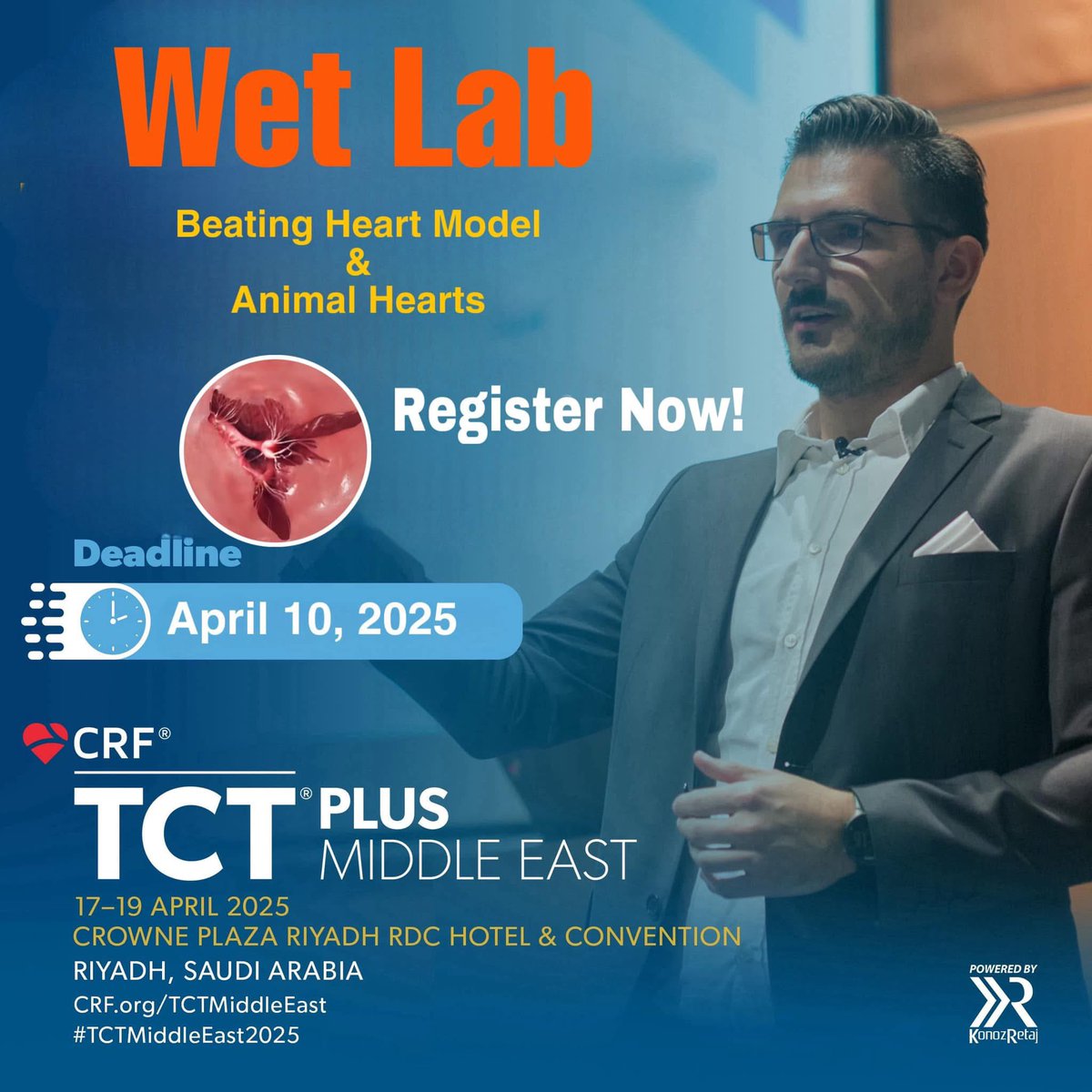 AnasNomanMD's tweet photo. 🚨Submit Your Science for #TCT_ME 
🔑 Key Highlights:
🔬 Clinical Scholarships to Magdi Yacoub Heart Center
🧠 Hands-on Workshops: Wet Lab, Dry Lab
💡 $200K Prize in Shark Tank Innovation Competition
📝 Top Abstracts Published in JACC
Apply now: https://t.co/U0uKWZVOD5
@TCT_ME_ https://t.co/vTLyvMvW0b