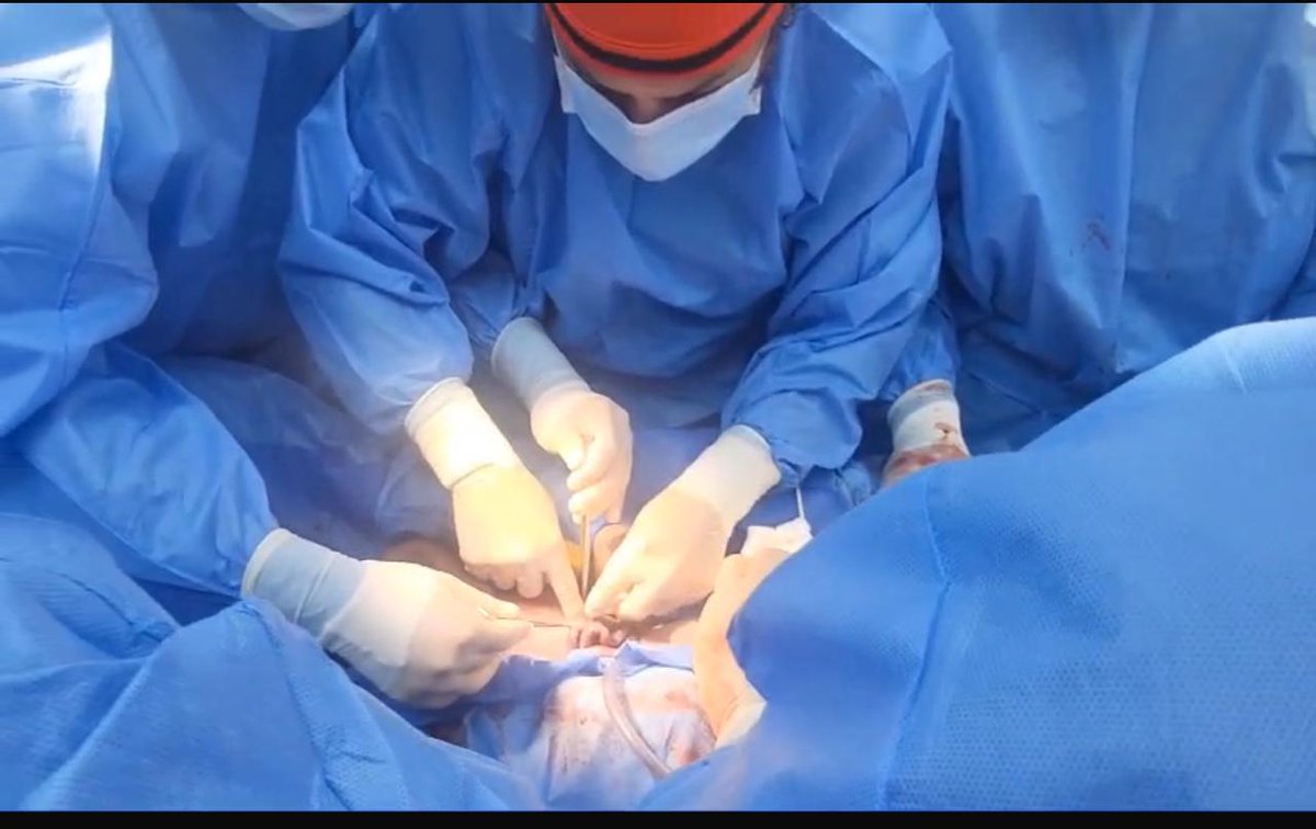 HUniversitarioG's tweet photo. #ElNuevoEcuadorResuelve| En el @HUniversitarioG se realizó cirugía durante cesárea a paciente con embarazo gemelar de 35 semanas, debido a malformación congénita gastrointestinal que presentó uno de los recién nacidos. https://t.co/z412AAqAUm