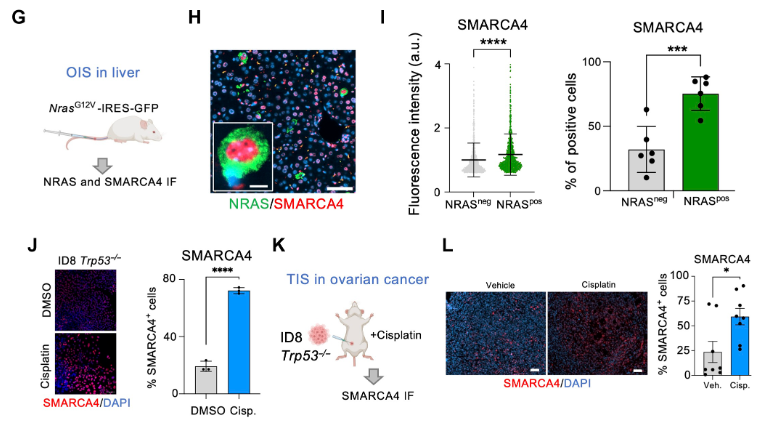 Waggoner Lab (@labwaggoner) on Twitter photo SMARCA4 inhibition enhances NK-mediated killing of senescent cells and can be combined with cisplatin to treat ovarian cancer
science.org/doi/10.1126/scâŠ
science.org/doi/10.1126/scâŠ
<a href="/ScienceAdvances/">Science Advances</a> <a href="/VirinderReen/">Virinder Reen</a> <a href="/DmitriyZamarin/">Dmitriy Zamarin MD PhD</a> SMARCA4 inhibition enhances NK-mediated killing of senescent cells and can be combined with cisplatin to treat ovarian cancer
science.org/doi/10.1126/scâŠ
science.org/doi/10.1126/scâŠ
<a href="/ScienceAdvances/">Science Advances</a> <a href="/VirinderReen/">Virinder Reen</a> <a href="/DmitriyZamarin/">Dmitriy Zamarin MD PhD</a>