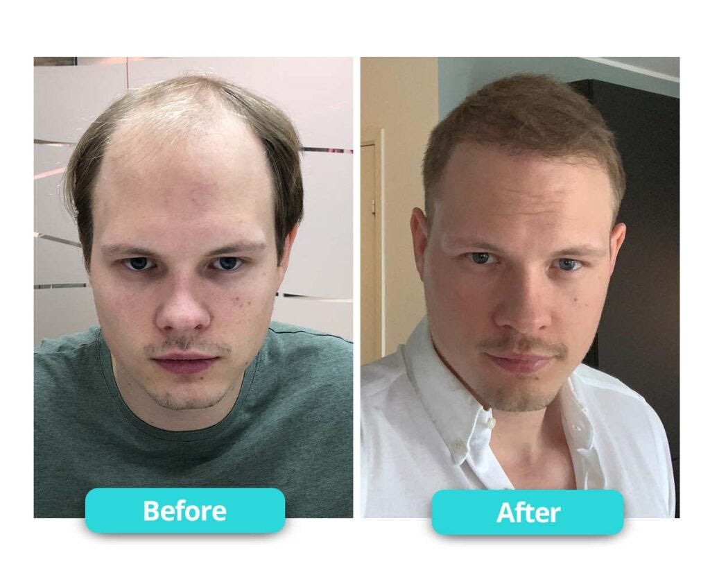 د.عبدالمحسن الهاجري استشاري جلدية tweet media