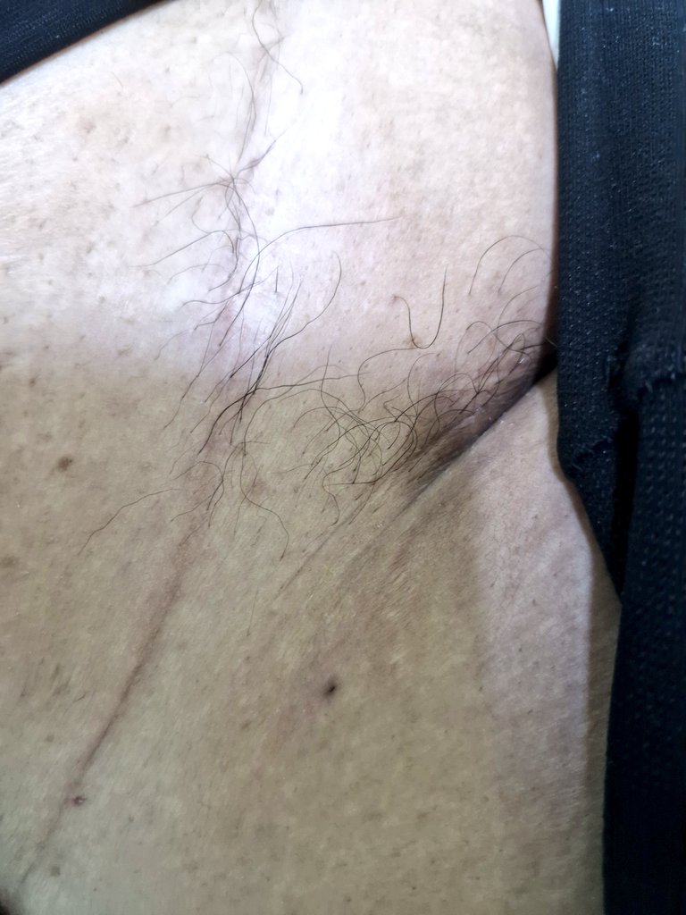 MonyBadillo's tweet photo. @Meymarco @BaurodMF Es que también no hay que ser.... ayer me llegó a la consulta de Cirugía General un barro... se lo juro un perro barro!! https://t.co/n0mxQfN12q
