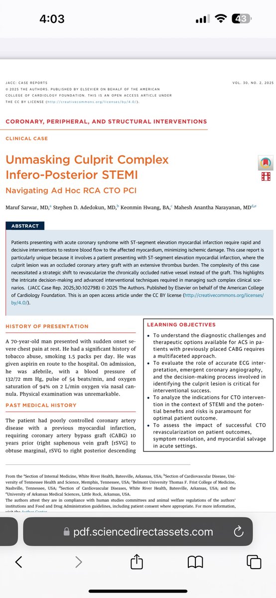 Mahesh Anantha MD (@mahesh_maidsh) on Twitter photo Race against time. Difficult to locate culprit in an inferior posterior stemi, requiring emergent RCA CTO intervention. Check out our case report- kwnsfk27.r.eu-west-1.awstrack.me/L0/https:%2F%2… #cardiotwitter #medtwitter #ahafit <a href="/ACCinTouch/">American College of Cardiology</a> <a href="/SCAI/">SCAI</a> <a href="/TCTMD/">TCTMD</a> <a href="/JACCJournals/">JACC Journals</a> <a href="/cvinnovations/">CV Innovations</a> <a href="/evandrofilhobr/">Evandro Martins F. MD</a> Race against time. Difficult to locate culprit in an inferior posterior stemi, requiring emergent RCA CTO intervention. Check out our case report- kwnsfk27.r.eu-west-1.awstrack.me/L0/https:%2F%2… #cardiotwitter #medtwitter #ahafit <a href="/ACCinTouch/">American College of Cardiology</a> <a href="/SCAI/">SCAI</a> <a href="/TCTMD/">TCTMD</a> <a href="/JACCJournals/">JACC Journals</a> <a href="/cvinnovations/">CV Innovations</a> <a href="/evandrofilhobr/">Evandro Martins F. MD</a>