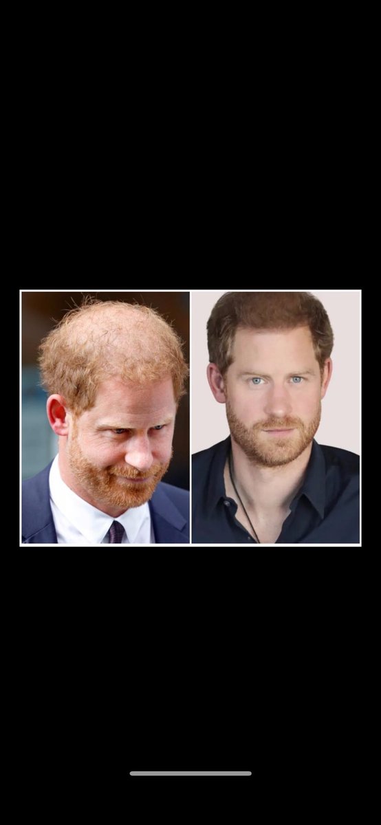 0Rthebest91033's tweet photo. #HarrysHairPiece ##RedHairAddicted #RedHairFakePrince
#HarryAndMeghanMarkleIsTheBiggestHypocrite #HarryYoureNotAVictimDude #HarryIsADisgustingAndVulgar #HarryIsAnAngryManChild #HarryIsToneDeaf #HarrysPRTragedyVultures #HarryExploitingTragedy https://t.co/undNr2HGAB
