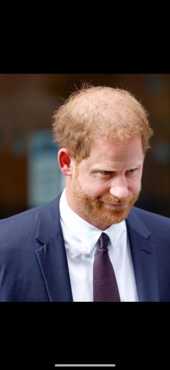0Rthebest91033's tweet photo. #HarrysHairPiece 
#HarryAndMeghanMarkleIsTheBiggestHypocrite #HarryYoureNotAVictimDude #HarryIsADisgustingAndVulgar #HarryIsAPatheticLittleBastard #HarryHavesNoShame #HarryAndMeghanAreBothDimwits #HarryAndMeghanAreAnnoying #HumiliationOfTheHarklesContinues #HarryExploitingTragedy https://t.co/26fosRYnYs