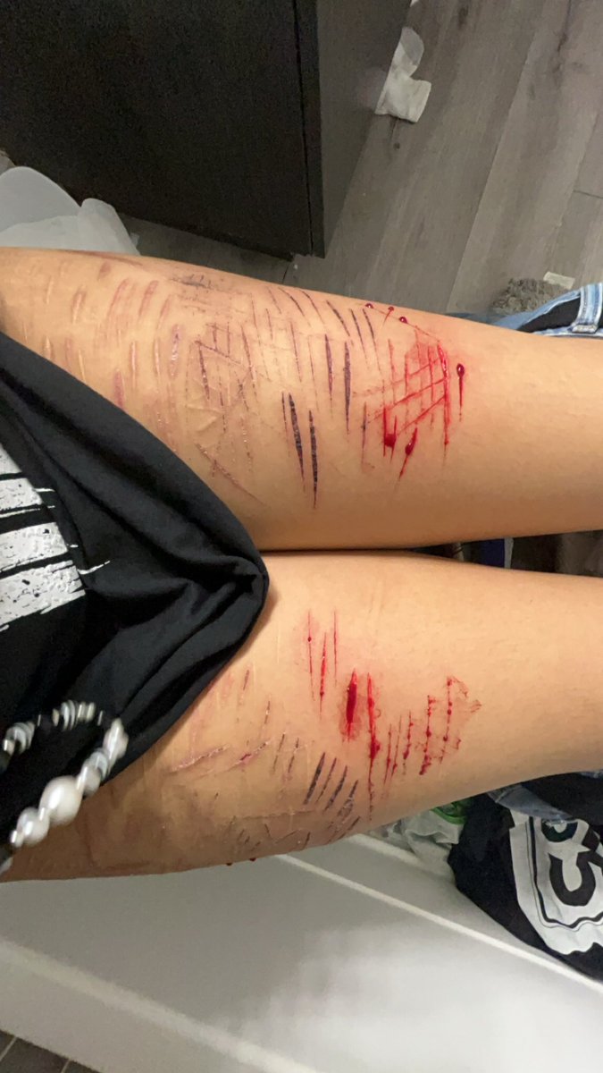 Ticcitoby__irl's tweet photo. HAHAHAHAHAHAHAHAHAHAHA IM GONNA TWEAK OUT SO BAD WHY IS MY PAIN TOLERANCE SO BAF HAHAHAHAAHGA I JUSY WANT FO HIT BEANS PLSLPLSPLSPLSPLSPLS HAHAHAHAHAHAH #smallbeans #babybeans #deepstyros https://t.co/PAGS8oYZeo