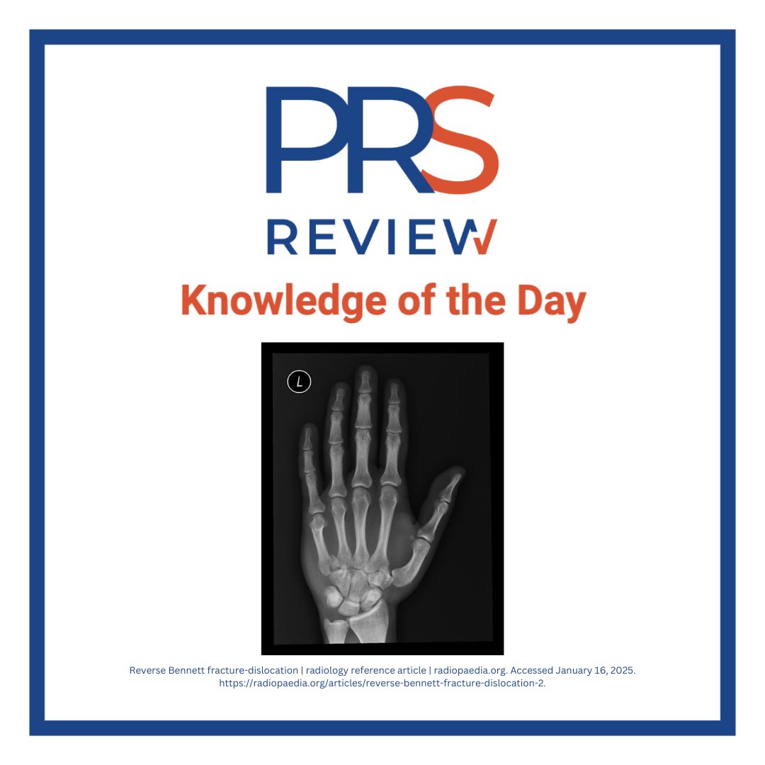 prsreview's tweet image. Reverse Bennett Fracture

#prsreview #handfracture #fingerfracture #fracture #handsurgery #orthopedicsurgery #sportsmedicine #microsurgery #plasticsurgery #reconstructivesurgery #medicaleducation #meded #plasticsurgeryresidency #plasticsurgeryfellowship #plasticsurgeon #surgery