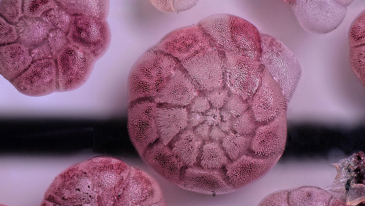 BIOspektrum (@spektrum_bio) on Twitter photo Eine internationale Studie unter Führung der <a href="/unihh/">Universität Hamburg</a> hat gezeigt, dass Foraminiferen in bisher ungeahntem Ausmaß Phosphat aus dem Wasser aufnehmen, das die Meere belastet.
nature.com/articles/s4158…
Bild: UHH/N. Glock Eine internationale Studie unter Führung der <a href="/unihh/">Universität Hamburg</a> hat gezeigt, dass Foraminiferen in bisher ungeahntem Ausmaß Phosphat aus dem Wasser aufnehmen, das die Meere belastet.
nature.com/articles/s4158…
Bild: UHH/N. Glock