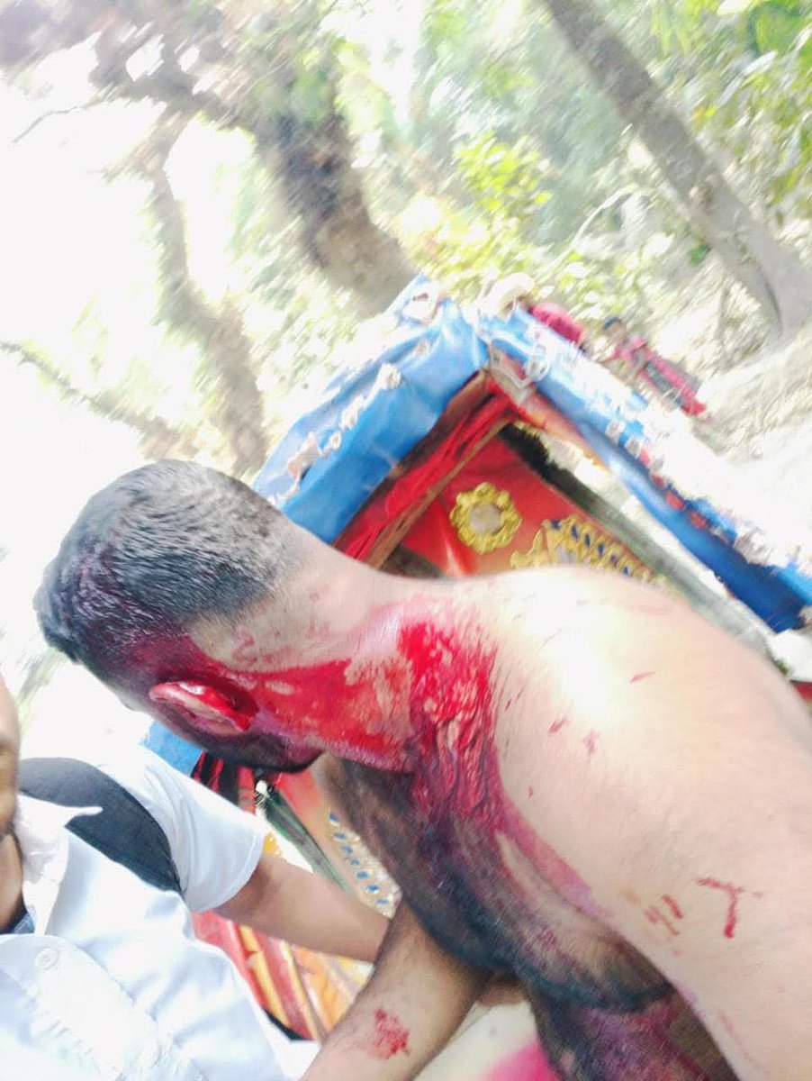 dhakaBd422199's tweet photo. #Monir Hossain, the General Secretary of the Barura Shaheed Smriti Government College Chhatra League in Comilla South District, was attacked by the terrorists of Chhatra Dal with the intention to murder him. The same situation is being witnessed across the country. We demand the blood of Chhatra League. Bangladesh Chhatra League strongly condemns and protests this attack. At the same time, we demand the highest punishment for those involved in the incident.
Attacks and lawsuits will not suppress Chhatra League. With the light of truth in hand, Chhatra League has been, is, and will always be on the streets. The end of this misrule is near. Victory is imminent.
You cannot suppress Chhatra League.
#JoyBangla
#JoyBangabandhu