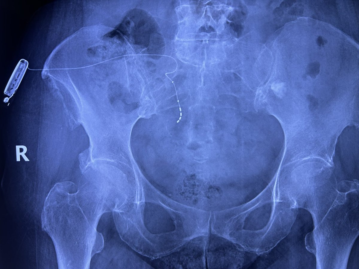 Spotter for Urology Residents .please comment