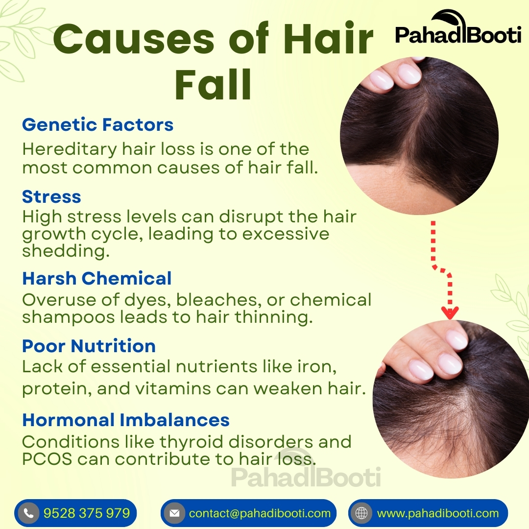 PAHADIBOOTI's tweet photo. Causes of Hair Fall...

#hairfall #hairtips #pahadibooti https://t.co/NcjQLf5ZOV