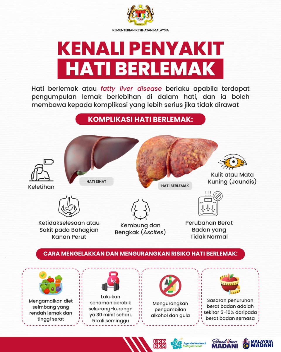 KKMPutrajaya's tweet photo. Hati merupakan organ dalaman terbesar yang terletak di bahagian kanan abdomen manusia. Hati mempunyai fungsi yang pelbagai. Ia bukan sahaja berfungsi untuk menyingkirkan toksin dari dalam darah tetapi juga memainkan peranan penting dalam mengawal proses metabolisma lemak, protein dan karbohidrat serta penghasilan enzim dan makromolekul yang diperlukan oleh badan. 

Oleh yang demikian, kesihatan hati perlu dijaga bagi memastikan hati dapat berfungsi secara normal dan optimum. Kuantiti lemak yang berlebihan di dalam hati adalah salah satu faktor yang boleh menyebabkan kemerosotan atau kegagalan fungsi hati. Keadaan ini dinamakan penyakit hati berlemak atau istilah saintifiknya Fatty Liver Disease.

Penyakit hati berlemak boleh dicegah dengan amalan gaya hidup sihat serta pengesanan awal melalui ujian saringan.

#KKMPrihatin
#MalaysiaSihat
#IhsanMADANI
#SkuadIhsanMADANI
#TaatSetia
#HarungiBersama