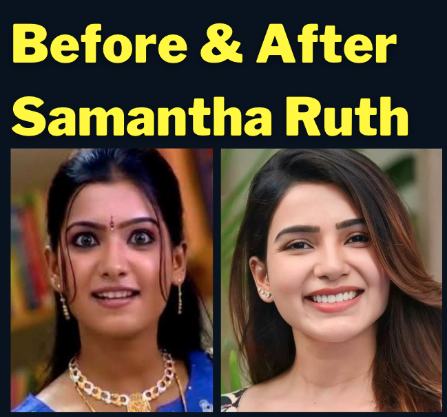 MeenaDasNarayan's tweet photo. #BeforeNAfter #SamanthaRuthPrabhu https://t.co/mucjlwhHWW